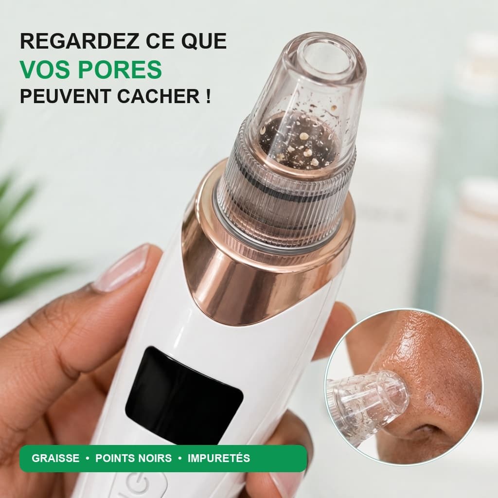 Aspirateur Points Noirs 3-en-1 Pro - Bénéfice 5